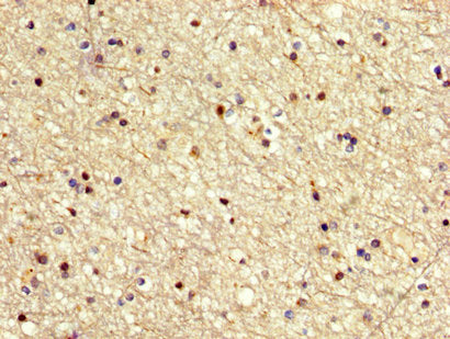 IHC image of CSB-PA621671LA01HU diluted at 1:500 and staining in paraffin-embedded human brain tissue performed on a Leica BondTM system. After dewaxing and hydration, antigen retrieval was mediated by high pressure in a citrate buffer (pH 6.0). S...