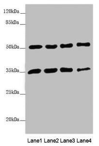 Western blot All lanes: MTX1 antibody at 3.78µg/ml Lane 1: Jurkat whole cell lysate Lane 2: A549 whole cell lysate Lane 3: HepG2 whole cell lysate Lane 4: MCF-7 whole cell lysate Secondary Goat polyclonal to rabbit IgG at 1/10000 dilution Predicte...
