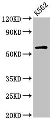 Western Blot Positive WB detected in: K562 whole cell lysate All lanes: IL10RA antibody at 2.7µg/ml Secondary Goat polyclonal to rabbit IgG at 1/50000 dilution Predicted band size: 64 kDa Observed band size: 64 kDa