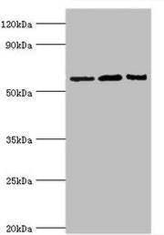 Western blot All lanes: Interleukin-10 receptor subunit alpha antibody at 8ug/ml Lane 1: Mouse heart tissue Lane 2: Hela whole cell lysate Lane 3: Mouse liver tissue Secondary Goat polyclonal to rabbit IgG at 1/10000 dilution Predicted band size:...