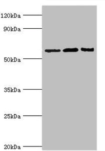 Western blot All lanes: Interleukin-10 receptor subunit alpha antibody at 8ug/ml Lane 1: Mouse heart tissue Lane 2: Hela whole cell lysate Lane 3: Mouse liver tissue Secondary Goat polyclonal to rabbit IgG at 1/10000 dilution Predicted band size:...