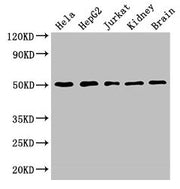 Western Blot Positive WB detected in: Hela whole cell lysate, HepG2 whole cell lysate, Jurkat whole cell lysate, Mouse kidney tissue, Mouse brain tissue All lanes: TUBA3C antibody at 3µg/ml Secondary Goat polyclonal to rabbit IgG at 1/50000 diluti...