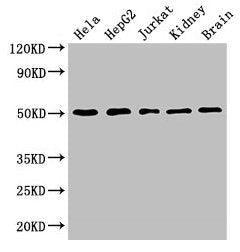 Western Blot Positive WB detected in: Hela whole cell lysate, HepG2 whole cell lysate, Jurkat whole cell lysate, Mouse kidney tissue, Mouse brain tissue All lanes: TUBA3C antibody at 3µg/ml Secondary Goat polyclonal to rabbit IgG at 1/50000 diluti...