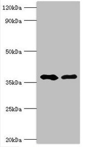 Western blot All lanes: Methylglutaconyl-CoA hydratase, mitochondrial antibody at 6ug/ml Lane 1: Rat brain tissue Lane 2: Rat kidney tissue Secondary Goat polyclonal to rabbit IgG at 1/10000 dilution Predicted band size: 36, 33 kDa Observed band s...