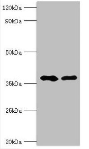 Western blot All lanes: Methylglutaconyl-CoA hydratase, mitochondrial antibody at 6ug/ml Lane 1: Rat brain tissue Lane 2: Rat kidney tissue Secondary Goat polyclonal to rabbit IgG at 1/10000 dilution Predicted band size: 36, 33 kDa Observed band s...