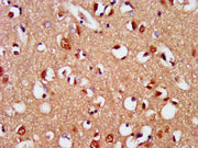 IHC image of CSB-PA621763LA01HU diluted at 1:400 and staining in paraffin-embedded human brain tissue performed on a Leica BondTM system. After dewaxing and hydration, antigen retrieval was mediated by high pressure in a citrate buffer (pH 6.0). S...