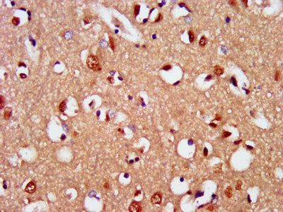 IHC image of CSB-PA621763LA01HU diluted at 1:400 and staining in paraffin-embedded human brain tissue performed on a Leica BondTM system. After dewaxing and hydration, antigen retrieval was mediated by high pressure in a citrate buffer (pH 6.0). S...