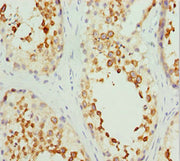 Immunohistochemistry of paraffin-embedded human testis tissue using CSB-PA621768ESR1HU at dilution of 1:100