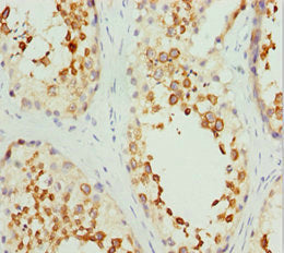 Immunohistochemistry of paraffin-embedded human testis tissue using CSB-PA621768ESR1HU at dilution of 1:100
