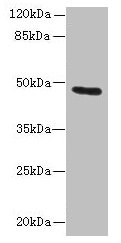 Western blot All lanes: KRT33B antibody at 1µg/ml + MCF-7 whole cell lysate Secondary Goat polyclonal to rabbit IgG at 1/10000 dilution Predicted band size: 47 kDa Observed band size: 47 kDa