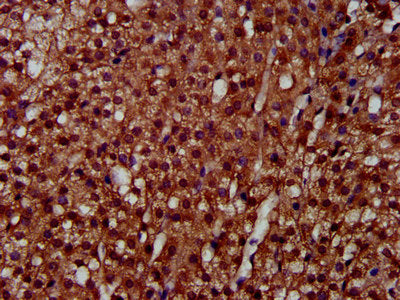 IHC image of CSB-PA621858LA01HU diluted at 1:300 and staining in paraffin-embedded human adrenal gland tissue performed on a Leica BondTM system. After dewaxing and hydration, antigen retrieval was mediated by high pressure in a citrate buffer (pH...