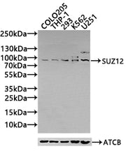 Western Blot Positive WB detected in: Rat kidney tissue, Rat liver tissue All lanes: SUZ12 antibody at 3.4ug/ml Secondary Goat polyclonal to rabbit IgG at 1/50000 dilution Predicted band size: 84 kDa Observed band size: 84 kDa