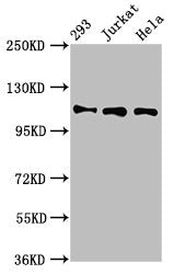 Western Blot Positive WB detected in: 293 whole cell lysate, Jurkat whole cell lysate, Hela whole cell lysate All lanes: RAB3GAP1 antibody at 7µg/ml Secondary Goat polyclonal to rabbit IgG at 1/50000 dilution Predicted band size: 111, 112, 106 kDa...