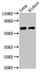 Western Blot Positive WB detected in: Rat lung tissue, Mouse kidney tissue All lanes: IQCB1 antibody at 3.2ug/ml Secondary Goat polyclonal to rabbit IgG at 1/50000 dilution Predicted band size: 69, 54, 35 kDa Observed band size: 69 kDa