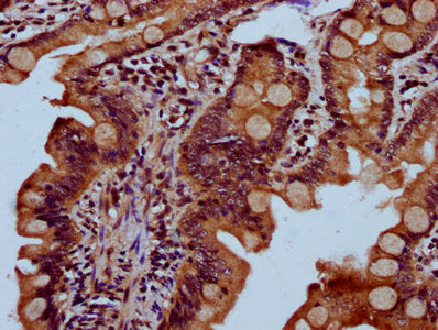 IHC image of CSB-PA621874LA01HU diluted at 1:300 and staining in paraffin-embedded human small intestine tissue performed on a Leica BondTM system. After dewaxing and hydration, antigen retrieval was mediated by high pressure in a citrate buffer (...