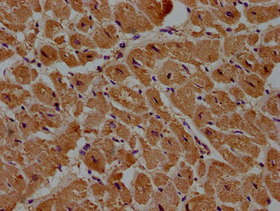 IHC image of CSB-PA621878LA01HU diluted at 1:100 and staining in paraffin-embedded human heart tissue performed on a Leica BondTM system. After dewaxing and hydration, antigen retrieval was mediated by high pressure in a citrate buffer (pH 6.0). S...