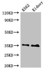 Western Blot Positive WB detected in: K562 whole cell lysate, Rat kidney tissue All lanes: TRADD antibody at 4ug/ml Secondary Goat polyclonal to rabbit IgG at 1/50000 dilution Predicted band size: 35, 28 kDa Observed band size: 35 kDa