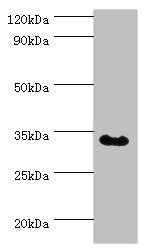 Western blot All lanes: Tumor necrosis factor receptor type 1-associated DEATH domain protein antibody at 12ug/ml + MCF-7 whole cell lysate Secondary Goat polyclonal to rabbit IgG at 1/10000 dilution Predicted band size: 35, 28 kDa Observed band s...