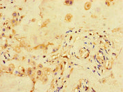 Immunohistochemistry of paraffin-embedded human placenta tissue using CSB-PA621880HA01HU at dilution of 1:100