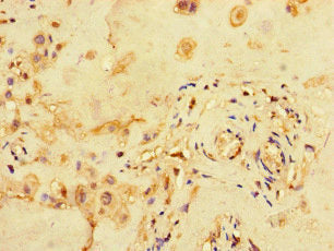 Immunohistochemistry of paraffin-embedded human placenta tissue using CSB-PA621880HA01HU at dilution of 1:100