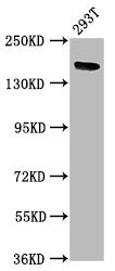 Western Blot Positive WB detected in: 293T whole cell lysate All lanes: ITSN1 antibody at 5µg/ml Secondary Goat polyclonal to rabbit IgG at 1/50000 dilution Predicted band size: 196, 138, 130, 188, 116, 195, 189, 134, 127, 126, 105 kDa Observed ba...