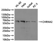 Western Blot Positive WB detected in: HL-60 whole cell lysate(20µg), Hela whole cell lysate(20µg), Jurkat whole cell lysate(20µg), PC-3 whole cell lysate(20µg) All lanes: CHRNA2 antibody at 1:1000 Secondary Goat polyclonal to rabbit IgG at 1/40000...