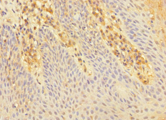 Immunohistochemistry of paraffin-embedded human tonsil tissue using CSB-PA621886ESR2HU at dilution of 1:100