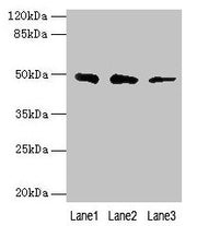 Western blot All lanes: ZBTB6 antibody at 8µg/ml Lane 1: Hela whole cell lysate Lane 2: HepG2 whole cell lysate Lane 3: 293T whole cell lysate Secondary Goat polyclonal to rabbit IgG at 1/10000 dilution Predicted band size: 49 kDa Observed band si...