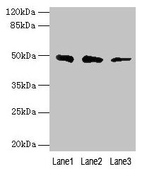 Western blot All lanes: ZBTB6 antibody at 8µg/ml Lane 1: Hela whole cell lysate Lane 2: HepG2 whole cell lysate Lane 3: 293T whole cell lysate Secondary Goat polyclonal to rabbit IgG at 1/10000 dilution Predicted band size: 49 kDa Observed band si...