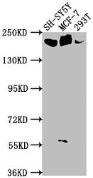 Western Blot Positive WB detected in: SH-SY5Y whole cell lysate, MCF-7 whole cell lysate, 293T whole cell lysate All lanes: LAMA4 antibody at 1:1000 Secondary Goat polyclonal to rabbit IgG at 1/50000 dilution Predicted band size: 203, 202, 13 kDa...