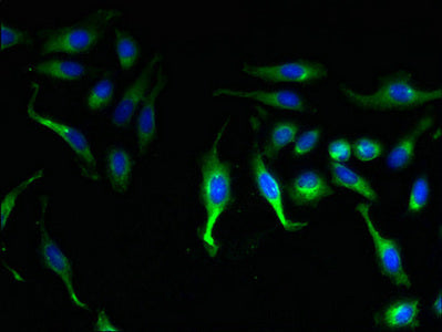 Immunofluorescent analysis of Hela cells using CSB-PA621958LA01HU at dilution of 1:100 and Alexa Fluor 488-congugated AffiniPure Goat Anti-Rabbit IgG(H+L)