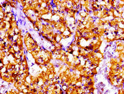 IHC image of CSB-PA621965LA01HU diluted at 1:100 and staining in paraffin-embedded human adrenal gland tissue performed on a Leica BondTM system. After dewaxing and hydration, antigen retrieval was mediated by high pressure in a citrate buffer (pH...