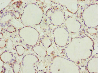 Immunohistochemistry of paraffin-embedded human thyroid tissue using CSB-PA621967ESR2HU at dilution of 1:100