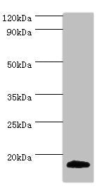 Western blot All lanes: MLANA antibody at 2ug/ml + Mouse eye tissue Secondary Goat polyclonal to rabbit IgG at 1/10000 dilution Predicted band size: 13 kDa Observed band size: 13 kDa