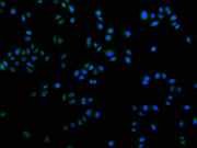 Immunofluorescence staining of Hela cells with CSB-PA621969LA21HU at 1:100, counter-stained with DAPI. The cells were fixed in 4% formaldehyde and blocked in 10% normal Goat Serum. The cells were then incubated with the antibody overnight at 4°C....