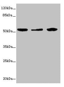 Western blot All lanes: KYNU antibody at 3.26ug/ml Lane 1: A549 whole cell lysate Lane 2: HepG2 whole cell lysate Lane 3: THP-1 whole cell lysate Secondary Goat polyclonal to rabbit IgG at 1/10000 dilution Predicted band size: 53, 35 kDa Observed...