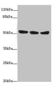 Western blot All lanes: KYNU antibody at 1.44ug/ml Lane 1: A549 whole cell lysate Lane 2: HepG2 whole cell lysate Lane 3: Hela whole cell lysate Secondary Goat polyclonal to rabbit IgG at 1/10000 dilution Predicted band size: 53, 35 kDa Observed b...