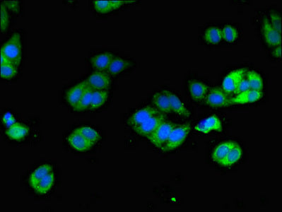 Immunofluorescent analysis of HepG2 cells using CSB-PA622516LA01HU at dilution of 1:100 and Alexa Fluor 488-congugated AffiniPure Goat Anti-Rabbit IgG(H+L)