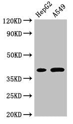 Western Blot Positive WB detected in: HepG2 whole cell lysate, A549 whole cell lysate All lanes: FOXI1 antibody at 3µg/ml Secondary Goat polyclonal to rabbit IgG at 1/50000 dilution Predicted band size: 41, 31 kDa Observed band size: 41 kDa