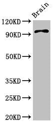 Western Blot Positive WB detected in: Mouse brain tissue All lanes: ABR antibody at 3.4ug/ml Secondary Goat polyclonal to rabbit IgG at 1/50000 dilution Predicted band size: 98, 94, 36, 93 kDa Observed band size: 98 kDa
