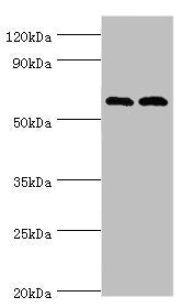 Western blot All lanes: Serine/threonine-protein kinase PAK 2 antibody at 2ug/ml Lane 1: Jurkat whole cell lysate Lane 2: Hela whole cell lysate Secondary Goat polyclonal to rabbit IgG at 1/10000 dilution Predicted band size: 58 kDa Observed band...