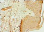Immunohistochemistry of paraffin-embedded human skin tissue using CSB-PA622653DSR1HU at dilution of 1:100