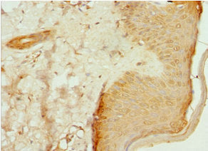 Immunohistochemistry of paraffin-embedded human skin tissue using CSB-PA622653DSR1HU at dilution of 1:100