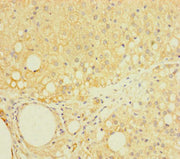 Immunohistochemistry of paraffin-embedded human adrenal gland tissue using CSB-PA622667LA01HU at dilution of 1:100