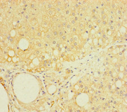 Immunohistochemistry of paraffin-embedded human adrenal gland tissue using CSB-PA622667LA01HU at dilution of 1:100