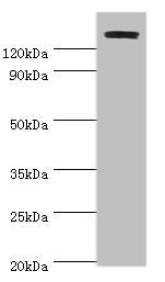 Western blot All lanes: TP53BP2 antibody at 2ug/ml + Mouse thymus Secondary Goat polyclonal to rabbit IgG at 1/10000 dilution Predicted band size: 126, 112, 127 kDa Observed band size: 126 kDa