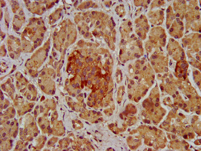 IHC image of CSB-PA622684LA01HU diluted at 1:200 and staining in paraffin-embedded human pancreatic tissue performed on a Leica BondTM system. After dewaxing and hydration, antigen retrieval was mediated by high pressure in a citrate buffer (pH 6....