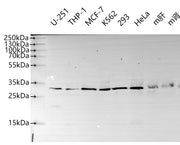 Western Blot Positive WB detected in: U251 whole cell lysate(30µg), THP-1 whole cell lysate(30µg), MCF-7 whole cell lysate(30µg), K562 whole cell lysate(30µg), HEK293 whole cell lysate(30µg), Hela whole cell lysate(30µg), Mouse liver tissue lysate...