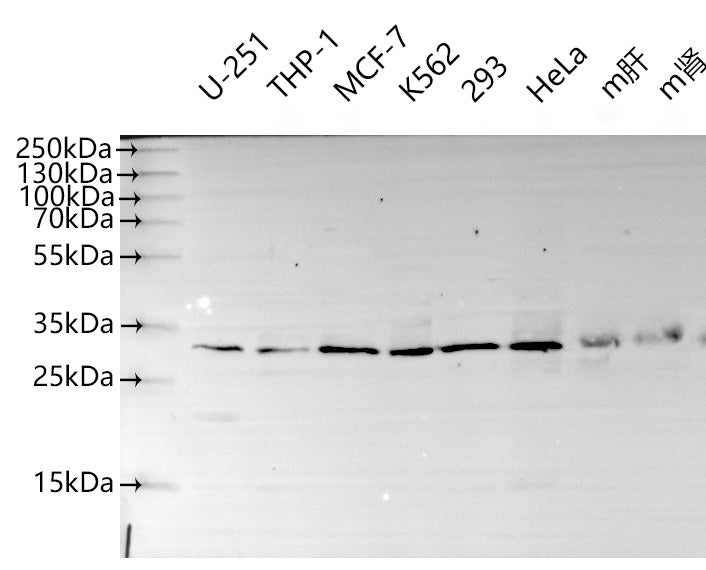 Western Blot Positive WB detected in: U251 whole cell lysate(30µg), THP-1 whole cell lysate(30µg), MCF-7 whole cell lysate(30µg), K562 whole cell lysate(30µg), HEK293 whole cell lysate(30µg), Hela whole cell lysate(30µg), Mouse liver tissue lysate...