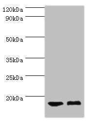 Western blot All lanes: COTL1 antibody at 5ug/ml Lane 1: Mouse brain tissue Lane 2: Mouse kidney tissue Secondary Goat polyclonal to rabbit IgG at 1/10000 dilution Predicted band size: 16 kDa Observed band size: 16 kDa